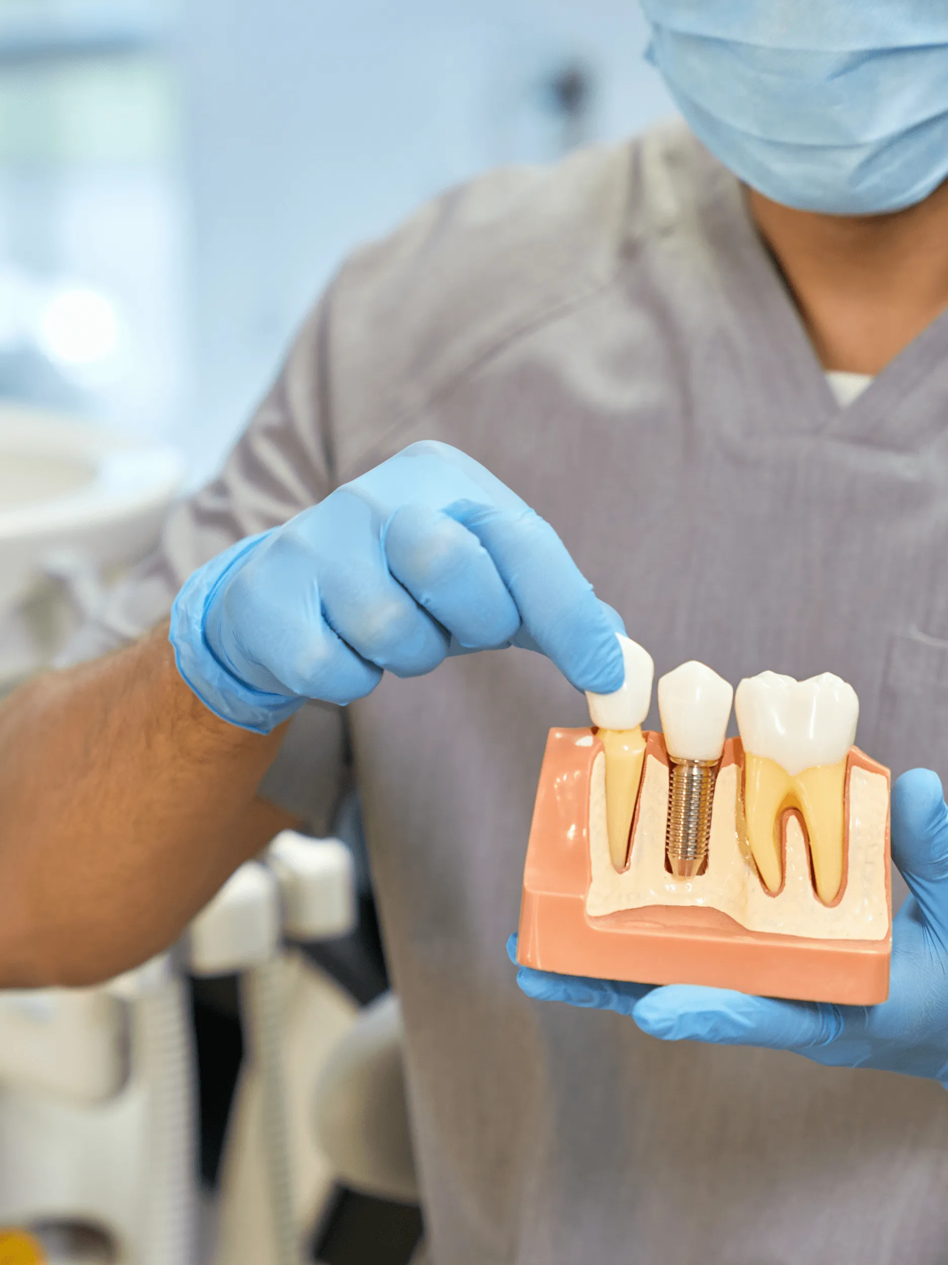 Dentist wearing blue gloves holding a dental implant model showing a natural tooth, a tooth implant with metal screw, and a tooth crown.