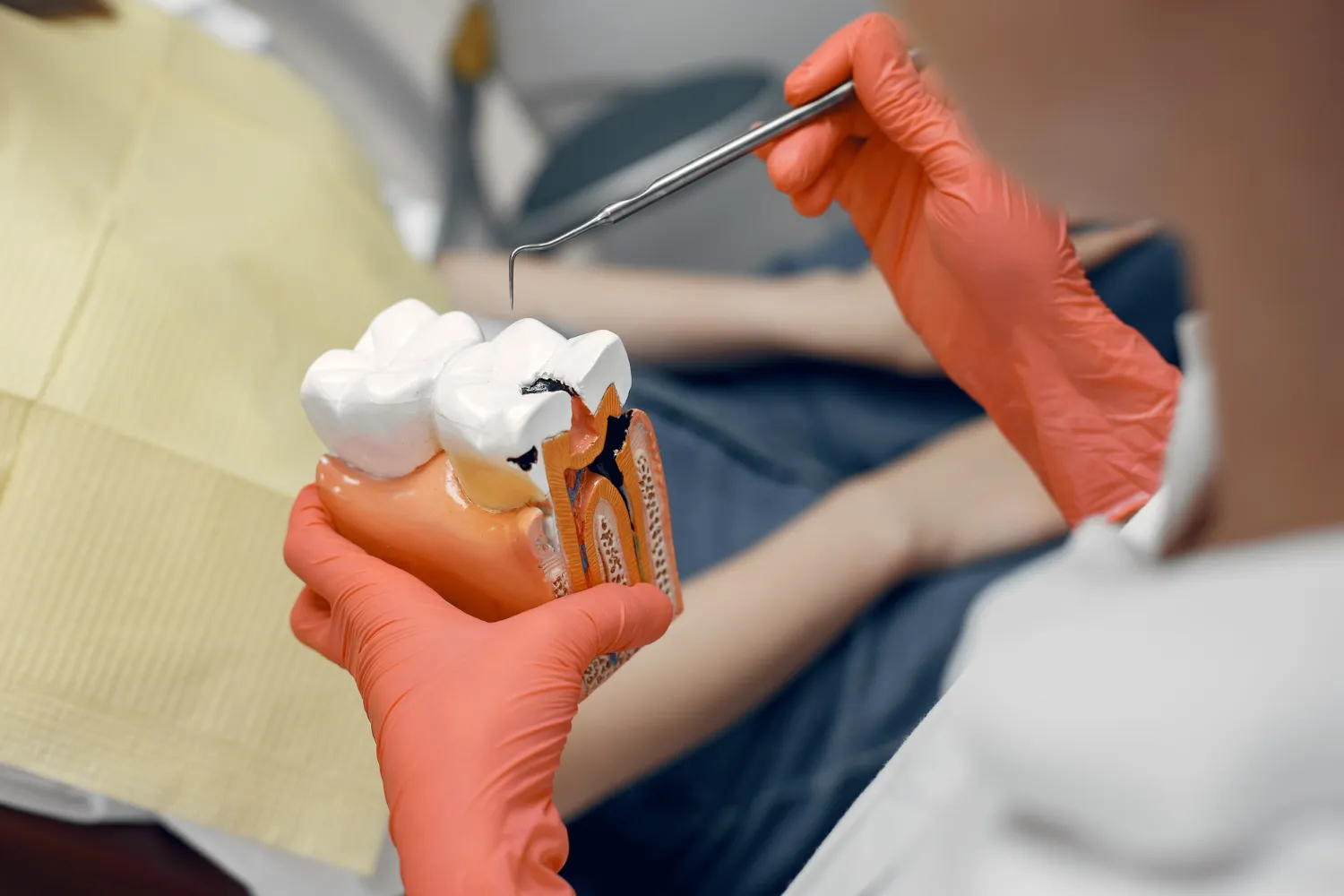 Dentist wearing orange gloves holding a tooth model showing tooth decay with a dental probe.