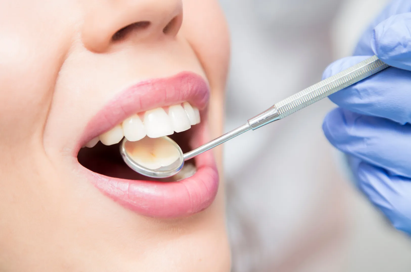Close-up of a dental checkup showing a dental mirror inside a patient's open mouth with gloved hand holding the tool.