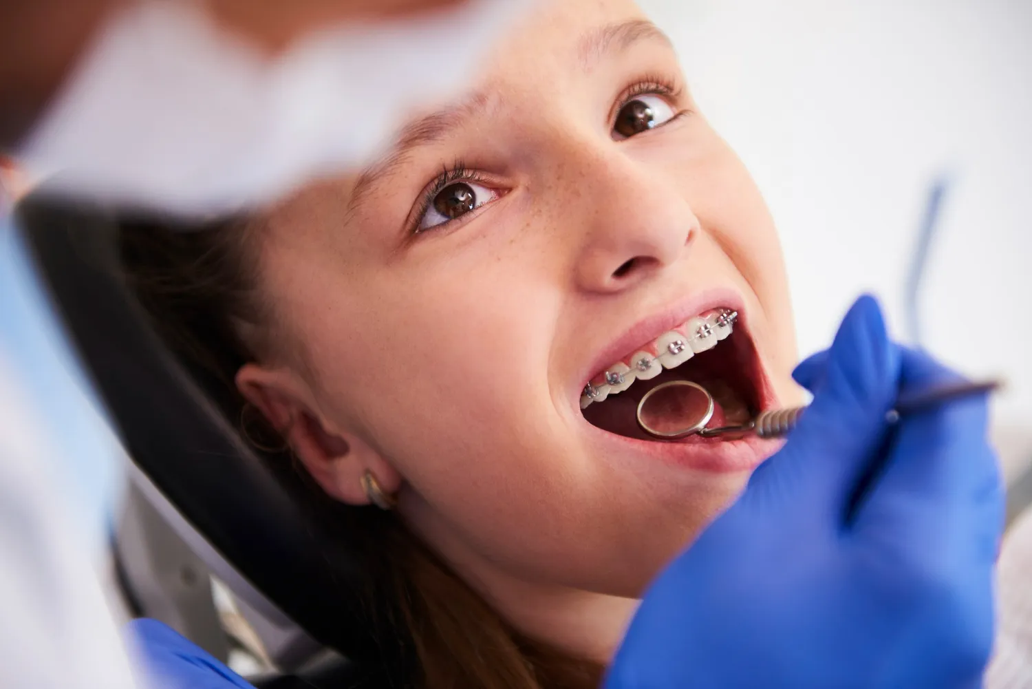 Young patient with braces having a dental checkup with a dentist holding a mirror inside the mouth.