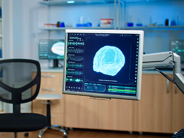 Monitor displaying a 3D image of the brain