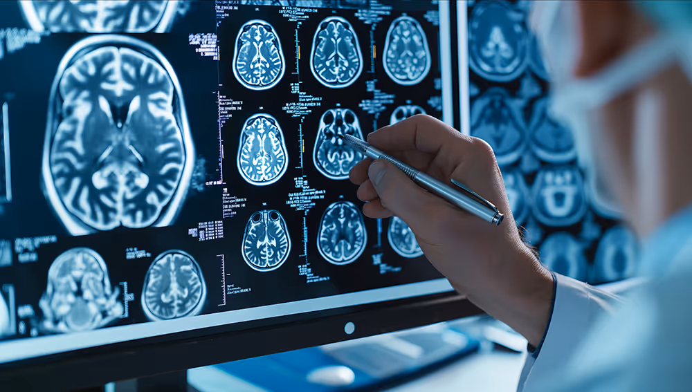 man pointing at a x-ray of a brain with a pen.