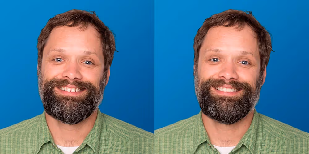 before and after pictures of a patient