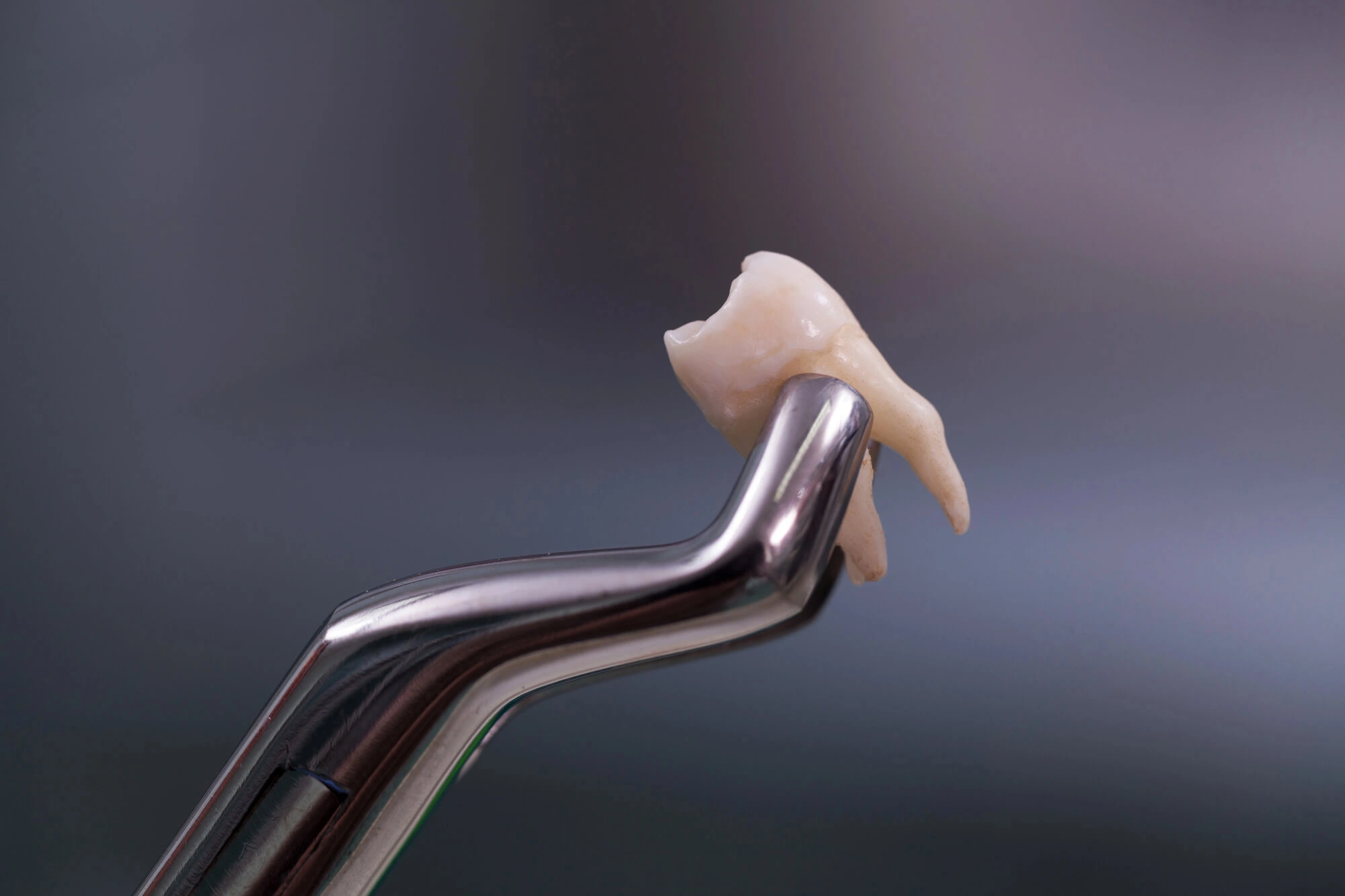 Tooth Extraction by dentist in 18045