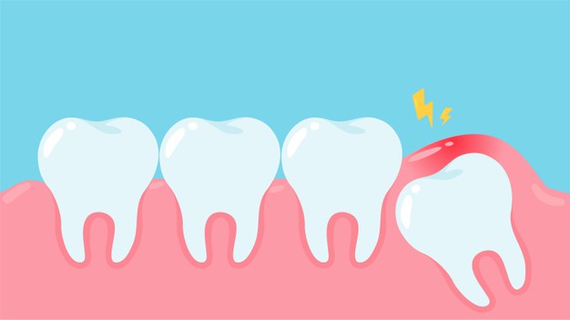 wisdom-teeth-gums-cause-pain-mouth-dental-care-dental-blog