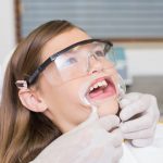 Cheek Retractors for Dental Photography