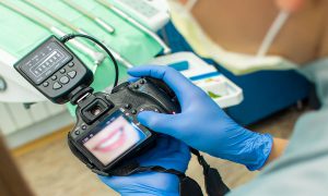 Dental photography