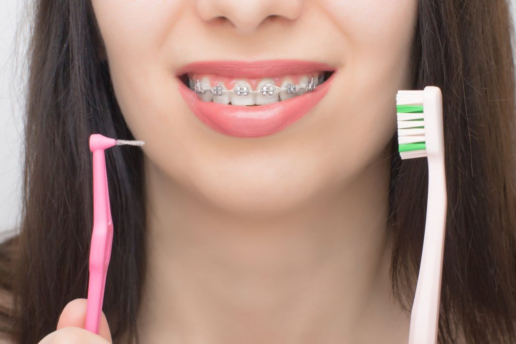 woman with teeth braces cleaning with tooth brush in on hand
