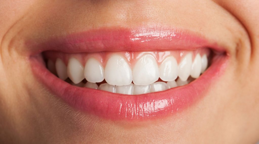 woman smile with white teeth