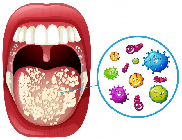 human-mouth-virus-infection