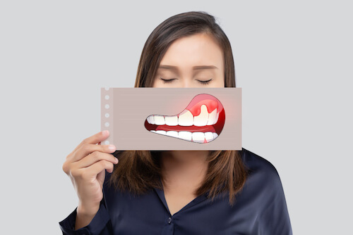 woman-dark-blue-shirt-holding-paper-with-periodontal-gingivitis