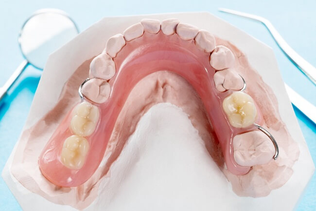 close-up-artificial-removable-partial-denture-temporary-partial-denture