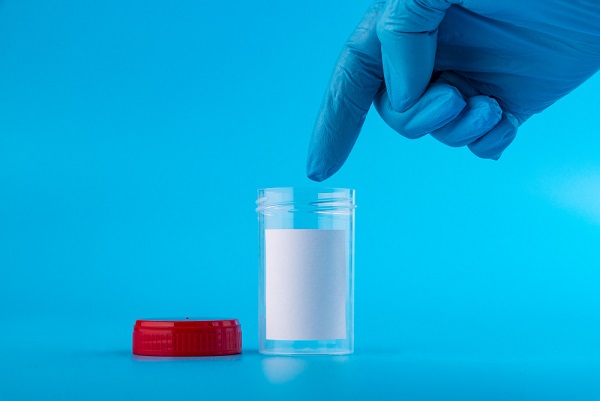 doctor-s-hand-blue-medical-glove-points-finger-container-urine-analysi