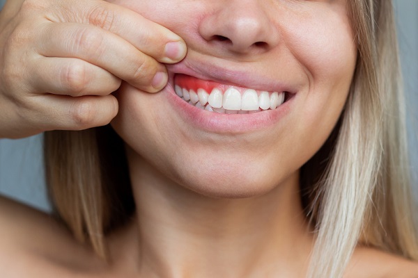 gum-inflammation-closeup-young-woman-showing-bleeding-gums-dentistry