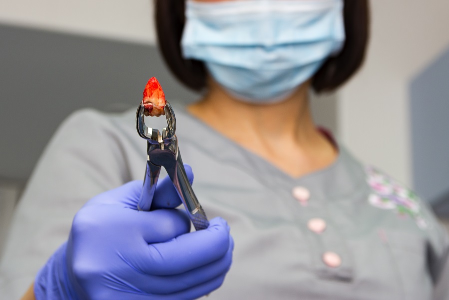 Pulled tooth in the metallic forceps