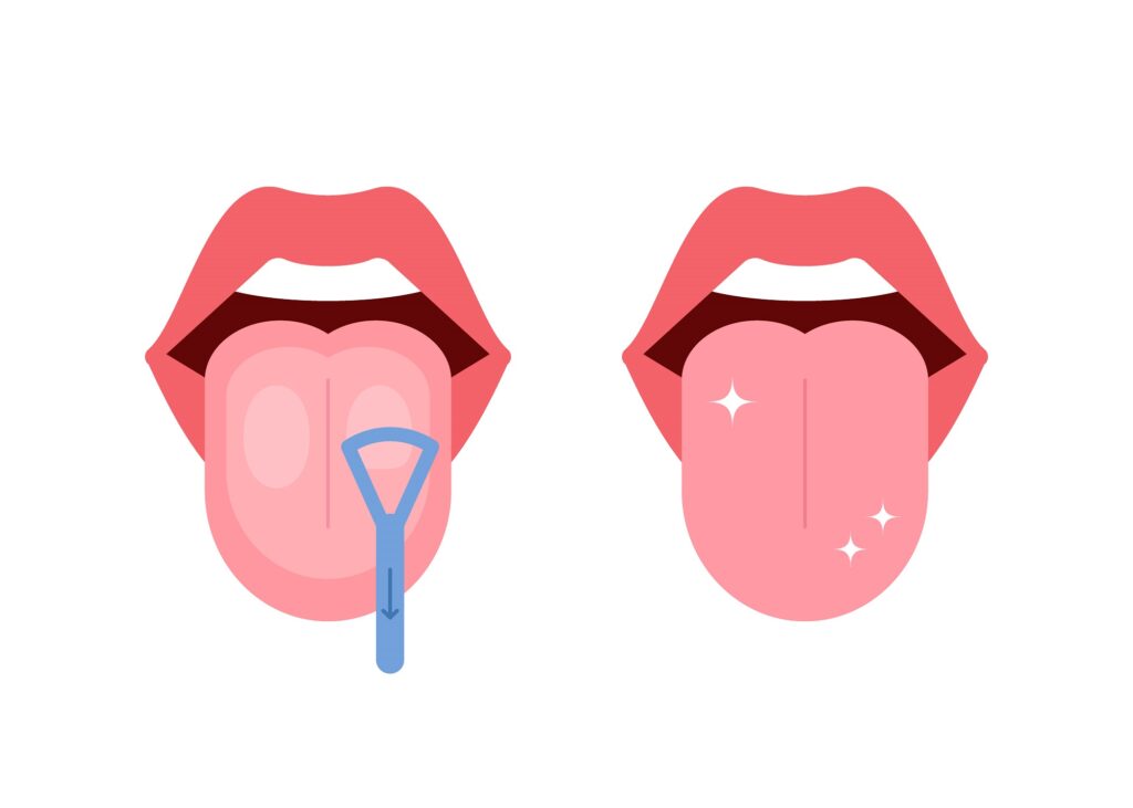 Benefits of tongue scraping - keeps tongue clean
