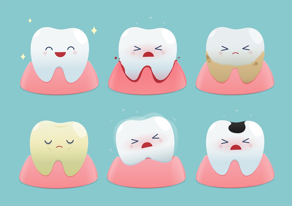 It all starts with plaque - Cavity to root canal stage