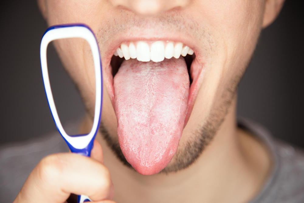 white-covered-coated-tongue-out-with-tiny-bumps-is-indicator-sickness-infections-for-not-using-tongue-scraper