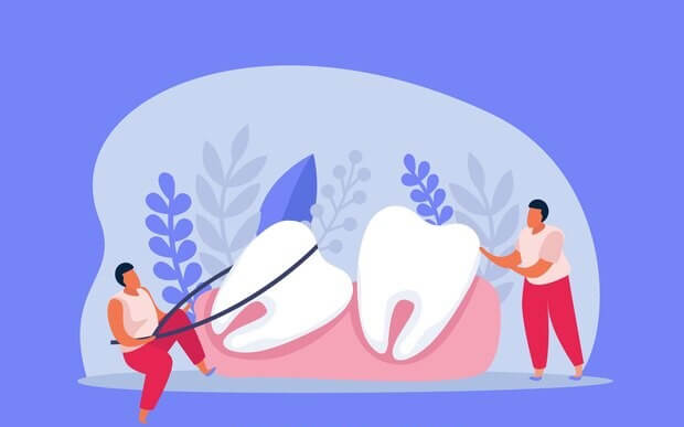 teeth reshaping