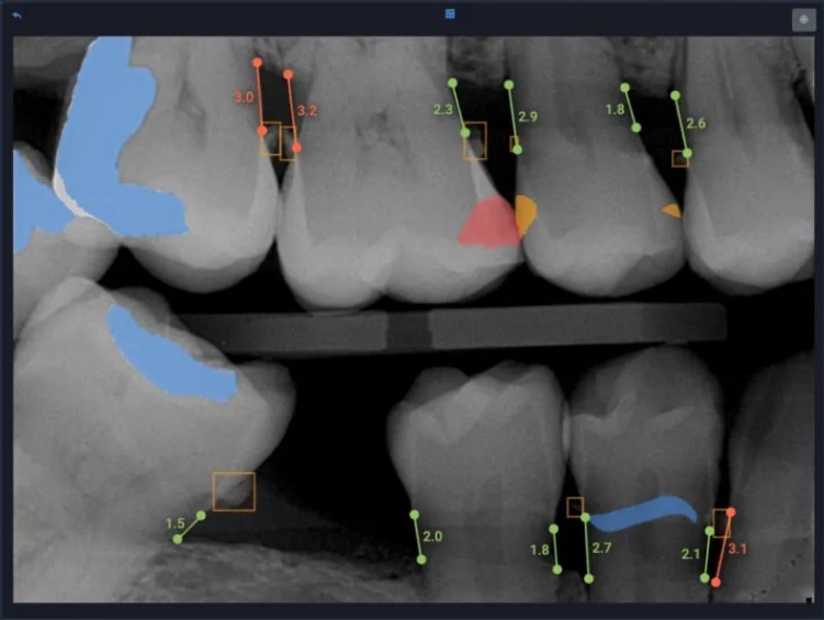 Radiographic Analysis Image