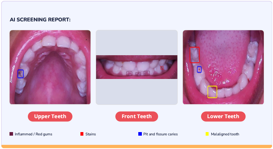 ScanO AI patient scan
