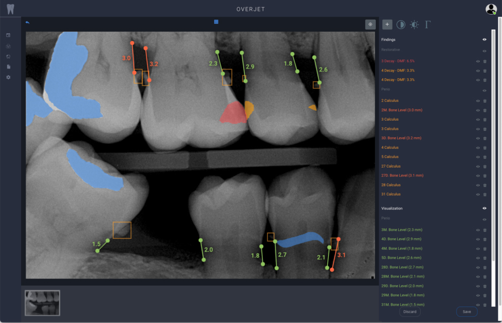 image of use of AI in dental radiography
