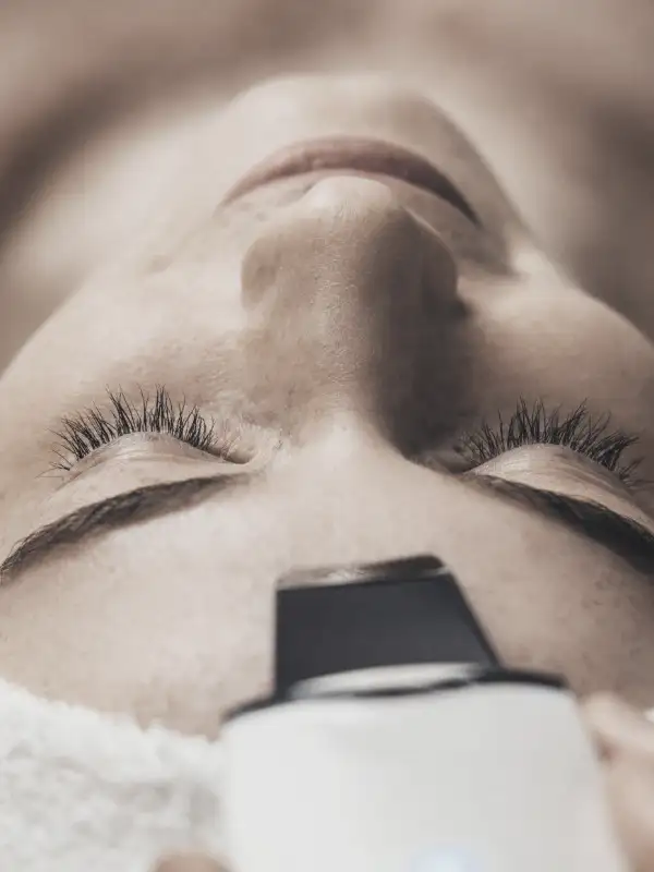 Peeling - Elan Riviera