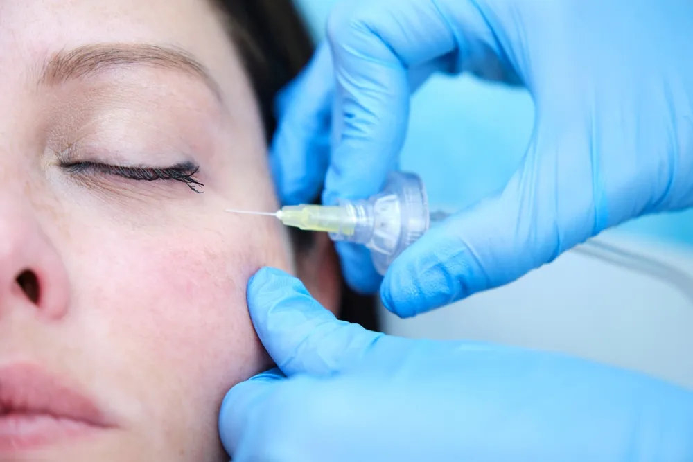 carboxytherapie aux centres laser murano