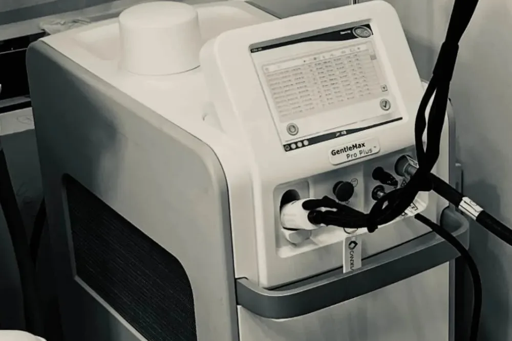 L'Ã©pilation laser derniÃ¨re gÃ©nÃ©ration Gentle max pro plus - Centre d'Ã©pilation laser murano