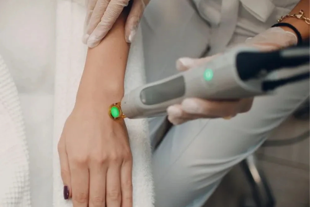 Epilation Laser: Entre Mythes et Réalités