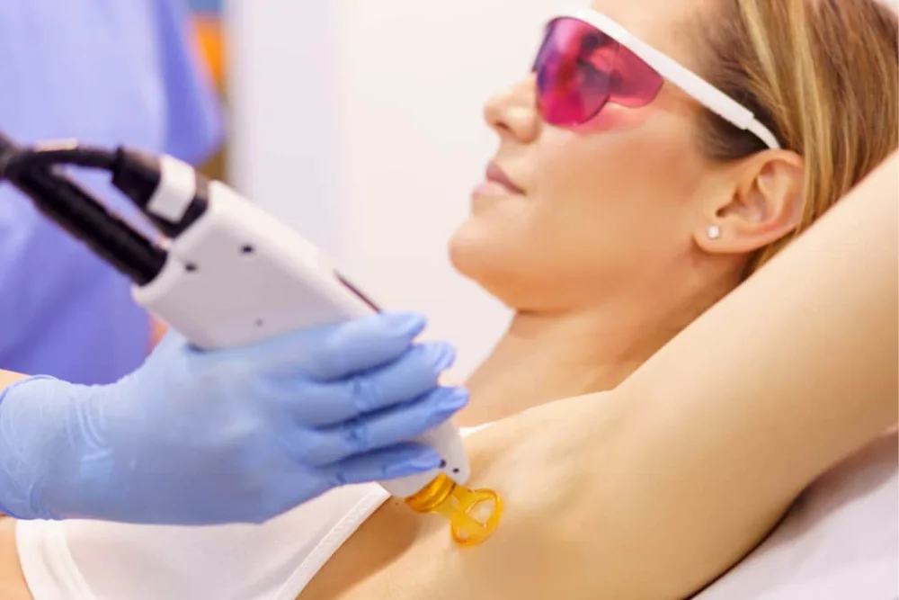 Épilation Laser définitive pour les sportifs - Centre Murano