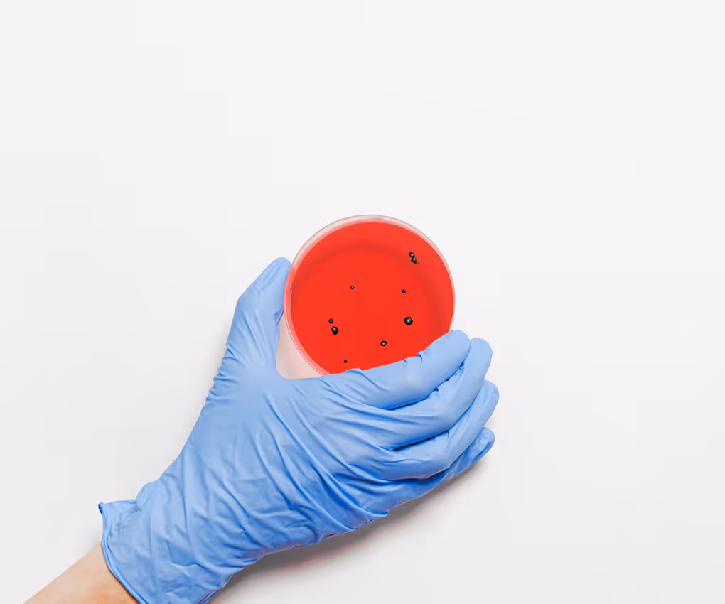 Sensibilidad para Hongos - Sanatorio Tandil