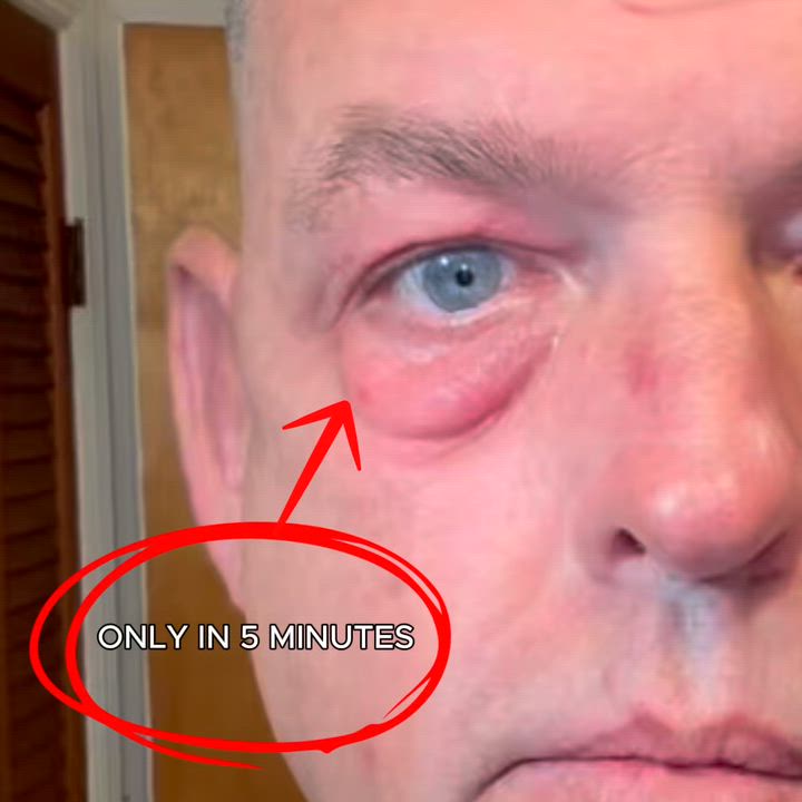 Applying Insideefy Lift Eye Gel