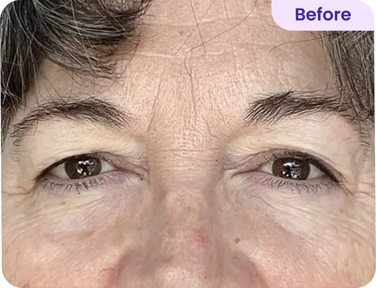 Before using LOVILDS Lift Eye Gel