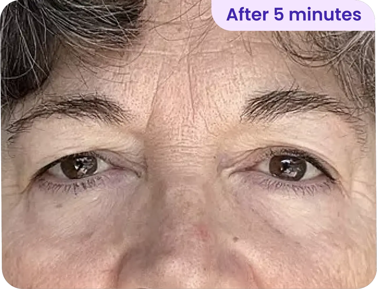 After using LOVILDS Lift Eye Gel