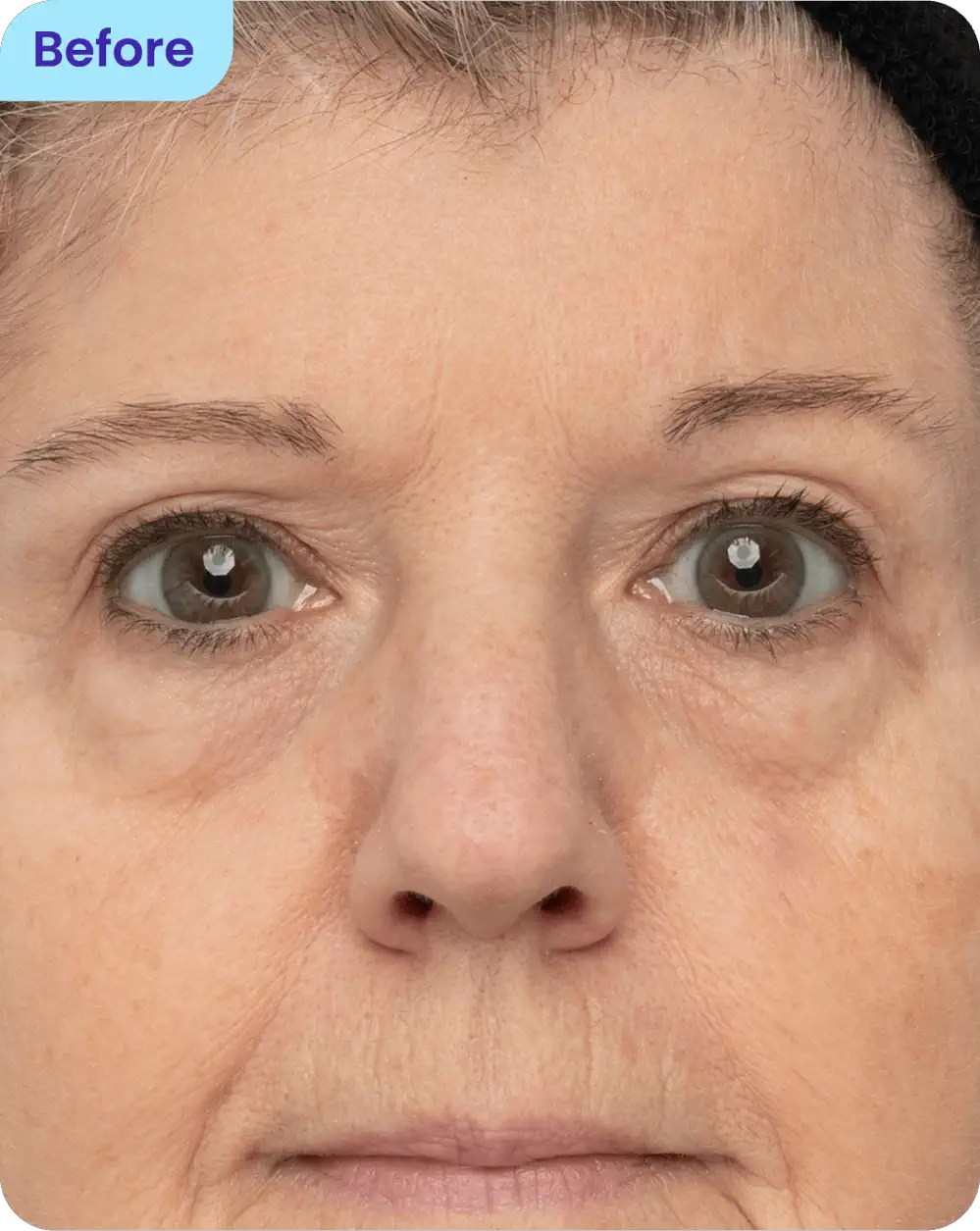 Skin appearance before treatment
