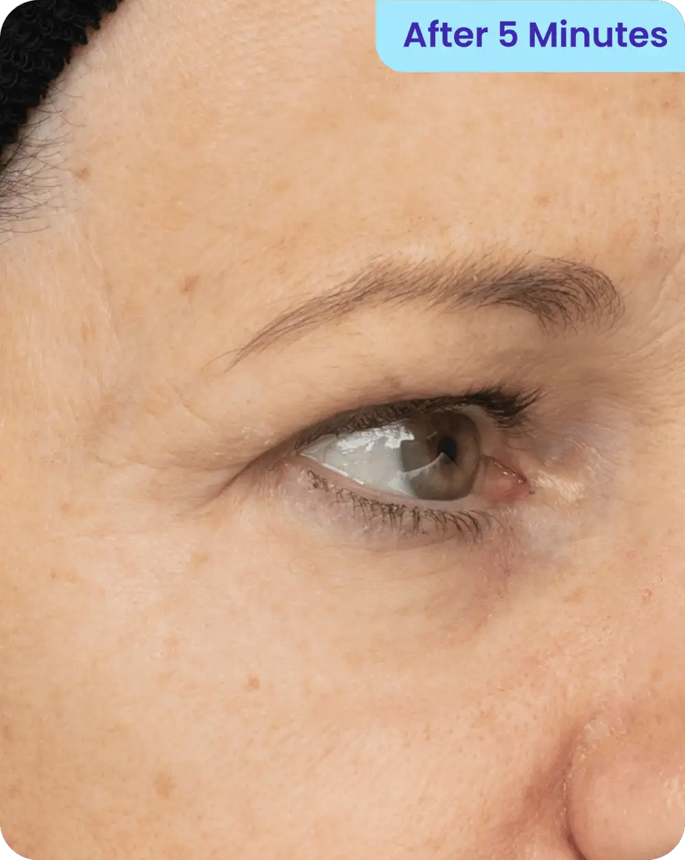 After using LOVILDS Lift Eye Gel for 5 minutes