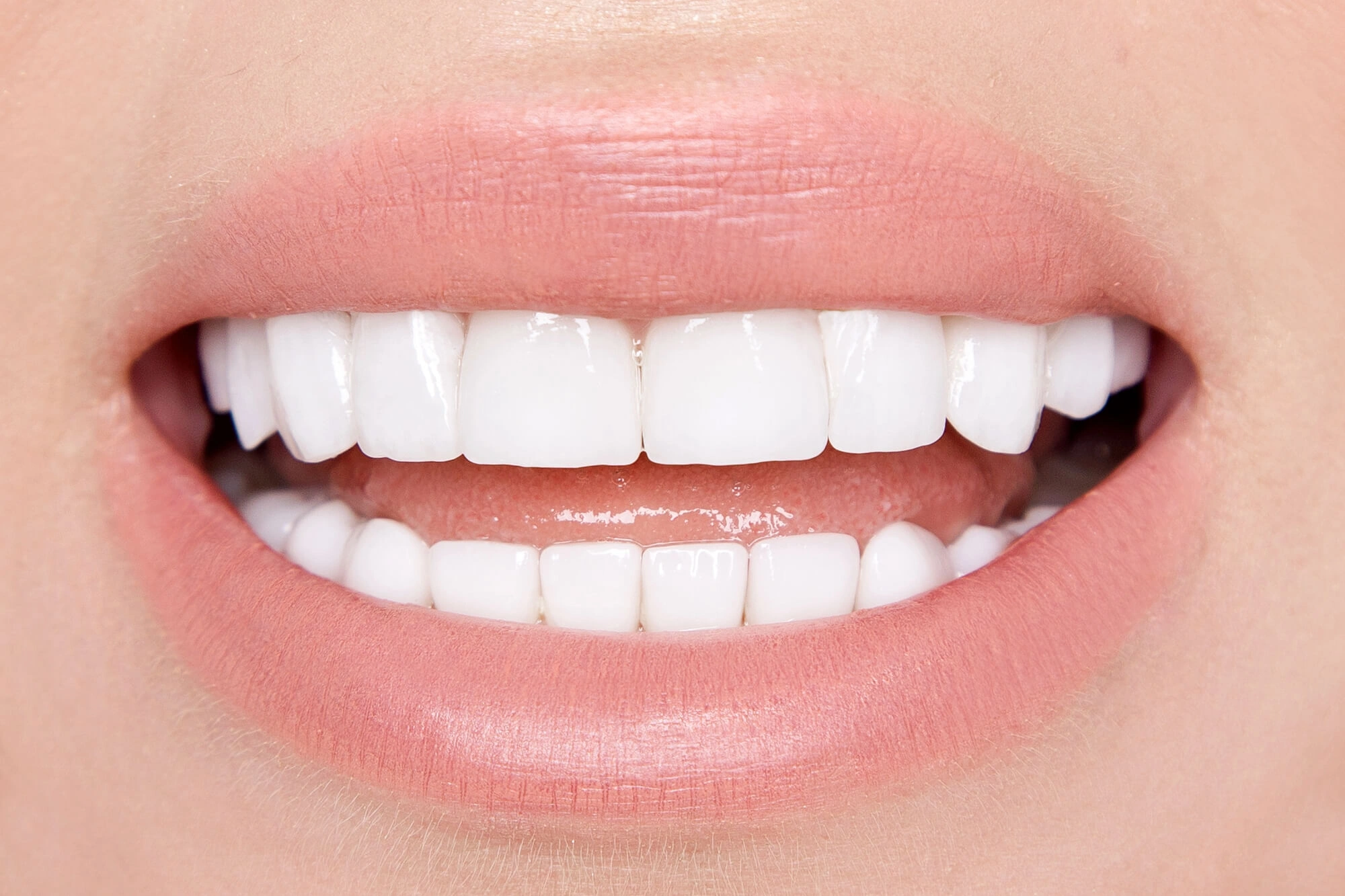 dental veneers montgomery al