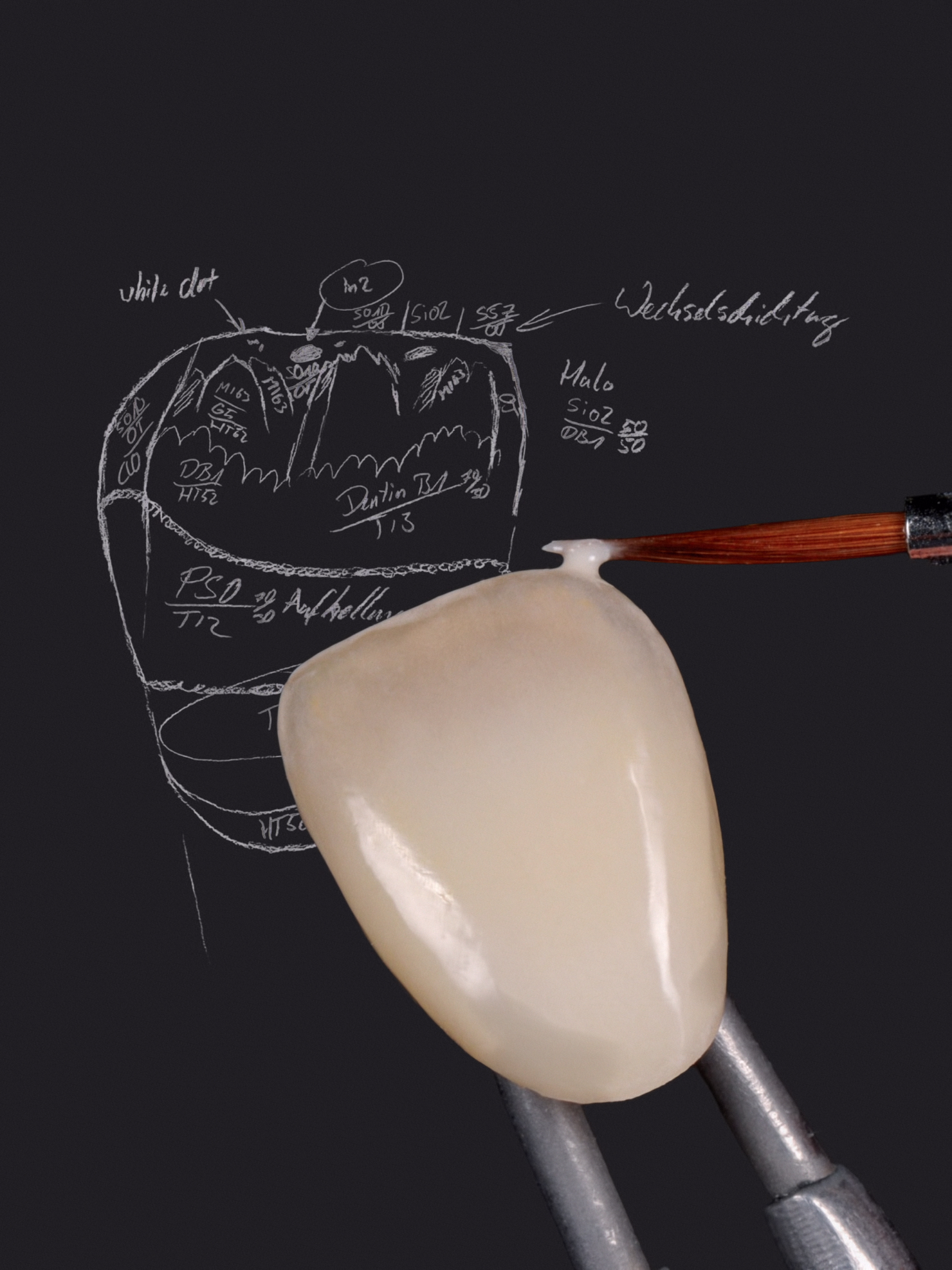Zahnmodell mit Beschriftungen in weiß auf schwarzem Hintergrund, eine Pinzette hält eine einzelne Zahnveneerschale, an deren Rand mit einem Pinsel Material aufgetragen wird.