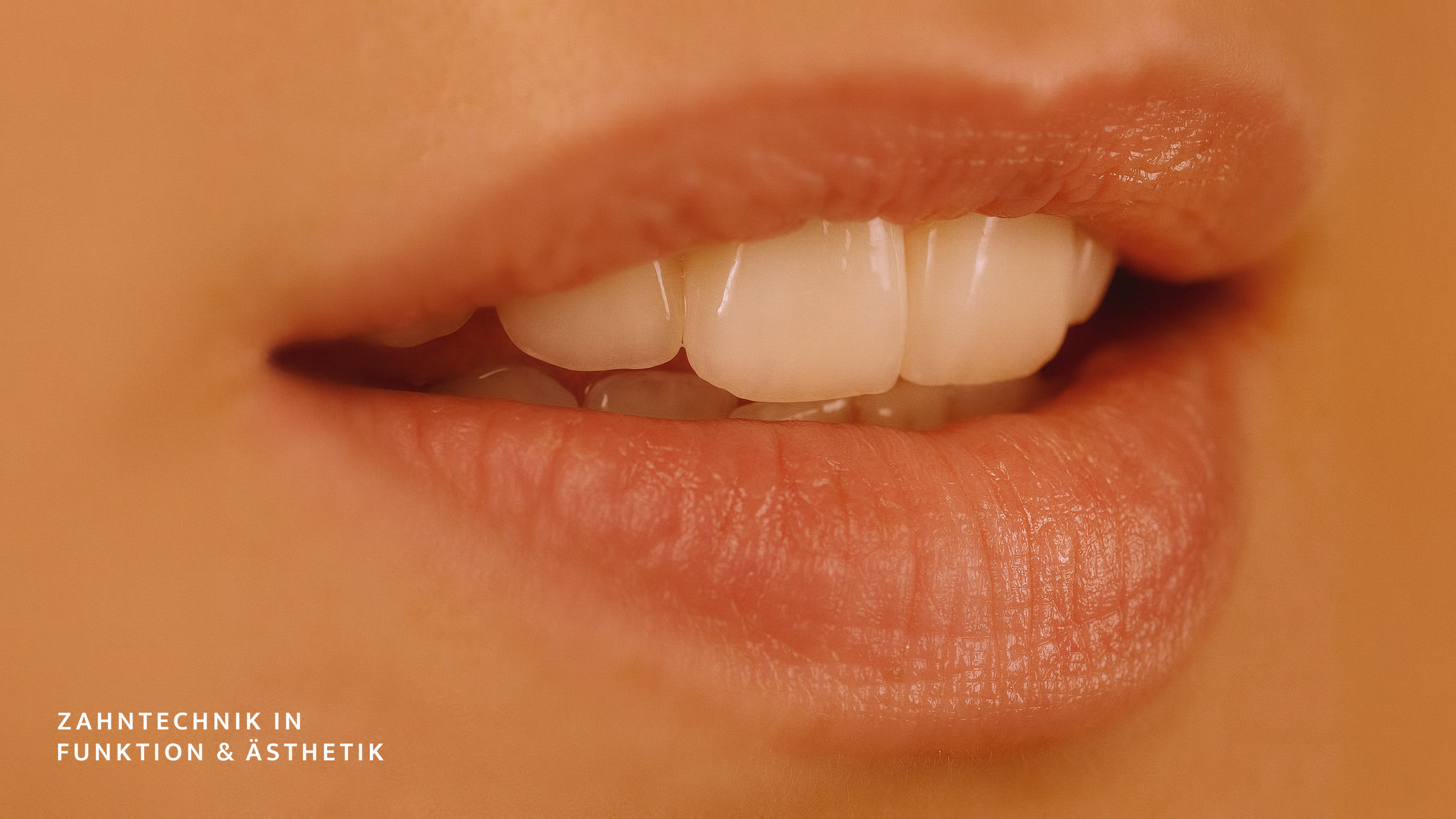 Makroaufnahme von Veneers bei Dental Design Gábor Filep – Zahntechnik, Ästhetik und Oberflächenstruktur im Detail.