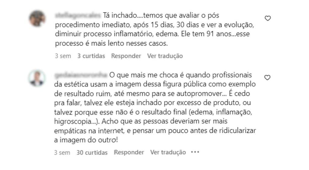 Assim como Stenio Garcia, outras celebridades também já foram alvo de críticas depois de aparecerem com aspecto de Pillow Face.