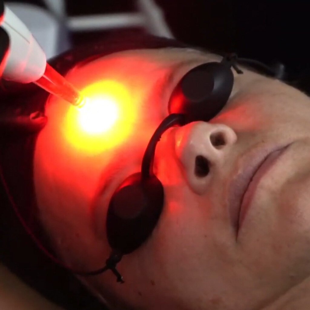O curso de eletrocautério e jato de plasma é uma técnica estética que remove tecido por meio de descarga elétrica e associa luz LED em 660nm para remover manchas e rejuvenescer a pele, com resultados ótimos e valor agregado aos pacientes. Com um equipamento portátil e seguro, profissionais da área estética podem tratar various problemas, como manchas, cicatrizes, estrias e mais, promovendo lifting facial e rejuvenescimento facial, braços e colo.