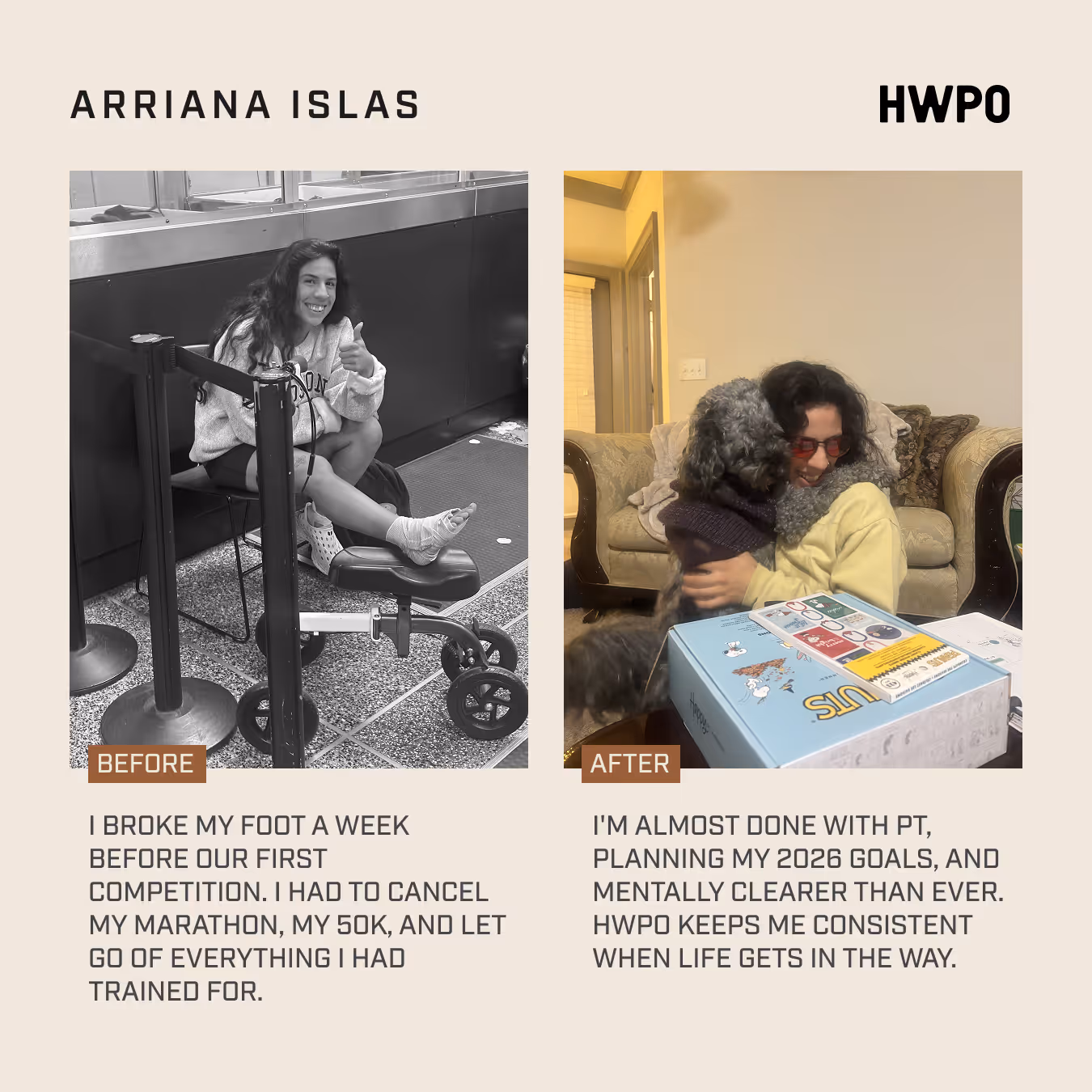 Before photo of a Ariana Islas with a broken foot. After photo she's hugging a dog.