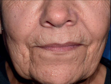 estyme-projection-18month-img