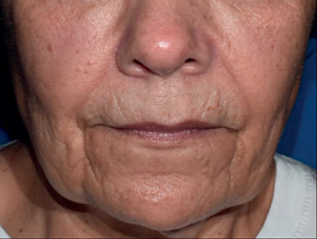 estyme-projection-6month-img