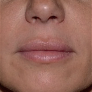 estyme-volume-6month-img