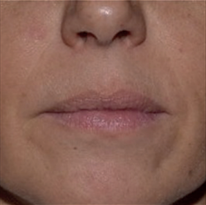 estyme-volume-baseline-img