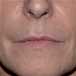 estyme-smooth-12month-img