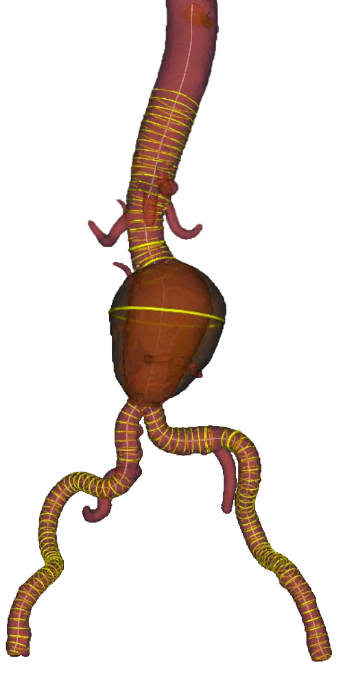 3D aortic reconstruction with automated centerline