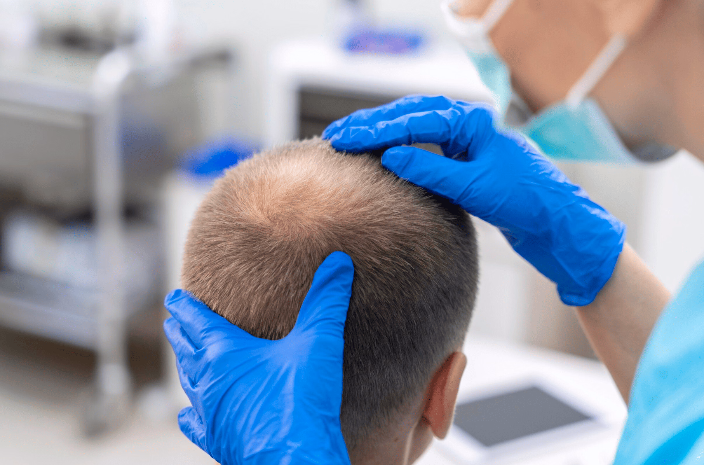 Medical professional checking scalp and hairline during consultation, illustrating how finasteride may support hair restoration